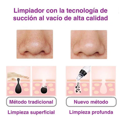 Limpiador de Puntos Negros